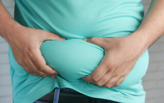 A man with Hypothalamic Obesity